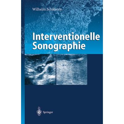 Interventionelle Sonographie, Taschenbuch von Wilhelm Schäberle, Springer Berlin, 978-3-642-64066-7