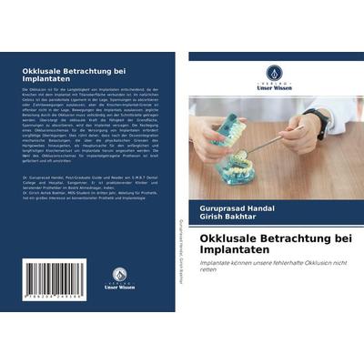 Okklusale Betrachtung bei Implantaten, Taschenbuch von Guruprasad Handal,Girish Bakhtar, Verlag Unser Wissen, 978-620-4-24918-6
