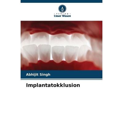 Implantatokklusion, Taschenbuch von Abhijit Singh, Verlag Unser Wissen, 978-620-8-89805-2