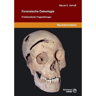Forensische Osteologie, Taschenbuch von Marcel A. Verhoff, Lehmanns Media, 978-3-86541-294-2