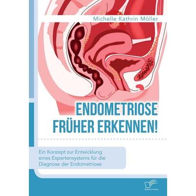 Endometriose früher erkennen! Ein Konzept zur Entwicklung eines Expertensystems für die Diagnose der Endometriose, Taschenbuch von Michelle Kathrin