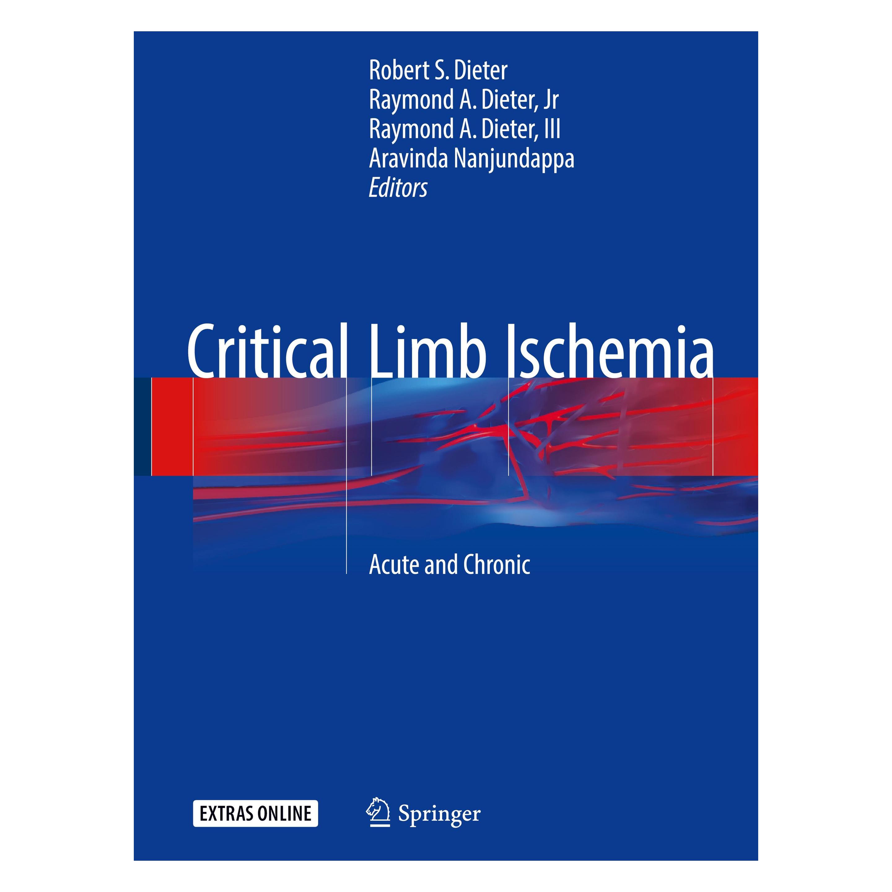 Springer Critical Limb Ischemia (Englisch, Hardcover, Aravinda Nanjundappa, III, JR, Raymond A. Dieter, Robert S. Dieter) (9783319319896)