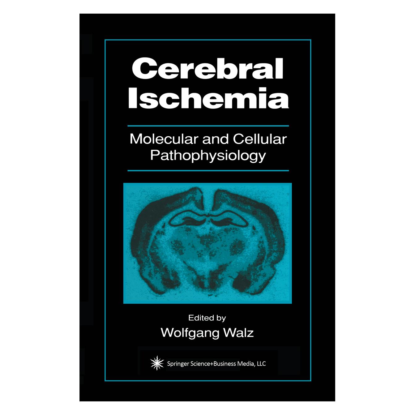 Springer Cerebral Ischemia (Englisch, Softcover, Wolfgang Walz) (55553064)
