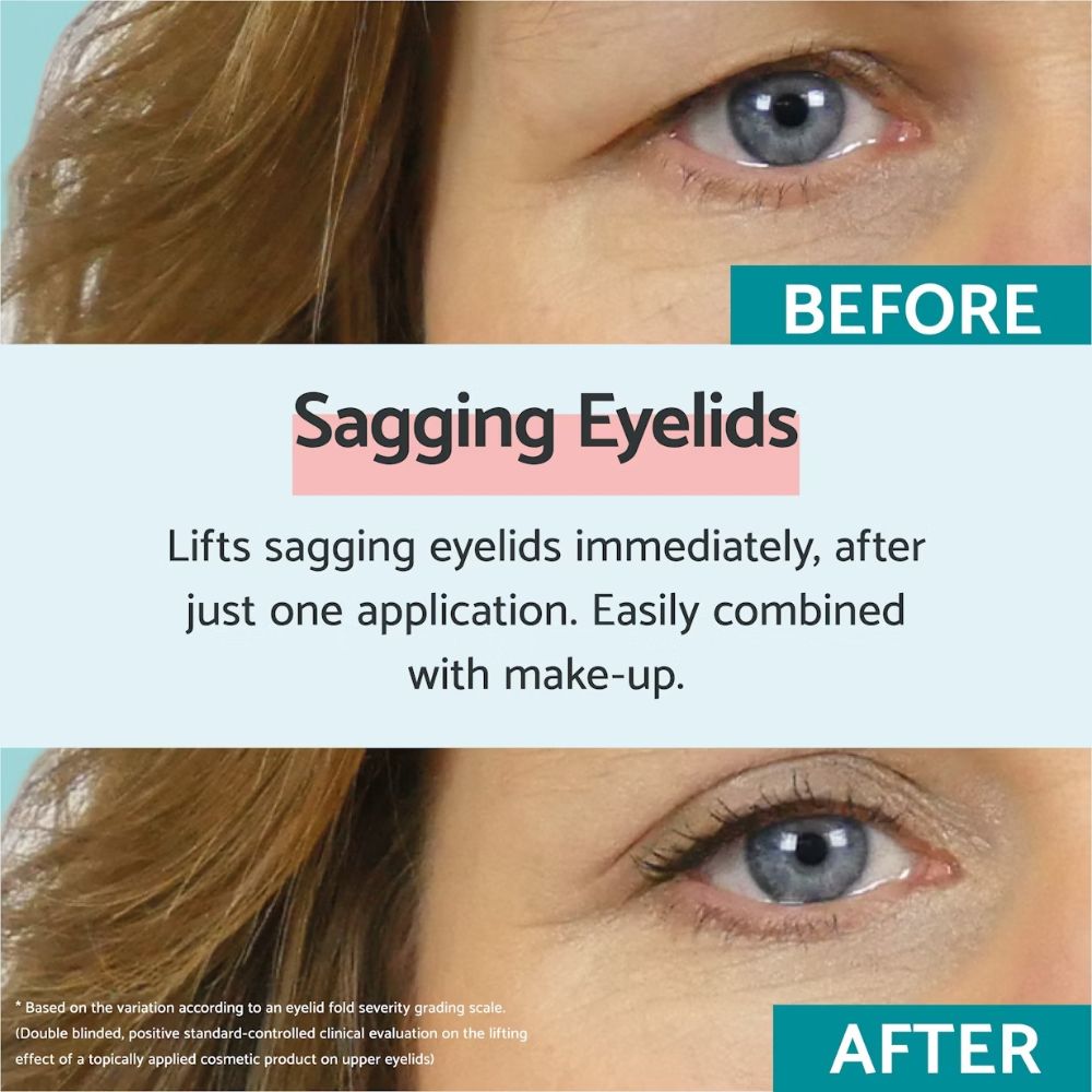 Remescar Sagging Eyelids Immediate Results 8mL