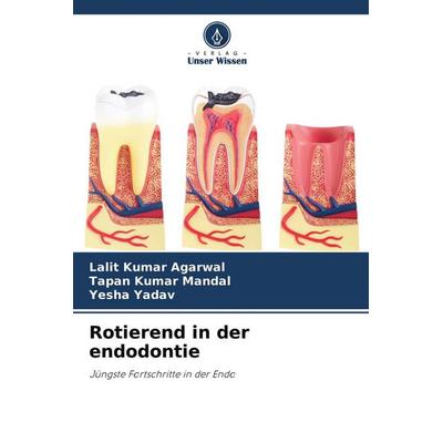 Rotierend in der endodontie, Taschenbuch von Lalit Kumar Agarwal,Tapan Kumar Mandal,Yesha Yadav, Verlag Unser Wissen, 978-620-4-17433-4