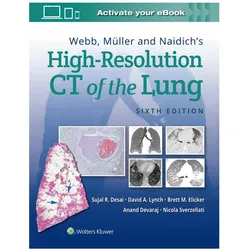 Webb, Muller and Naidich's High Resolution of Lung CT, Fachbücher von Brett M. Elicker, Sujal Desai, David A. Lynch, Anand Devaraj, Nicola Sverzellati