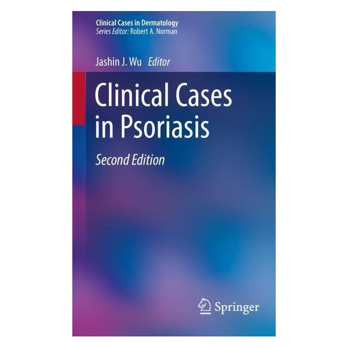 Springer Clinical Cases in Psoriasis (Englisch, Softcover, Jashin J. Wu) (56065213)