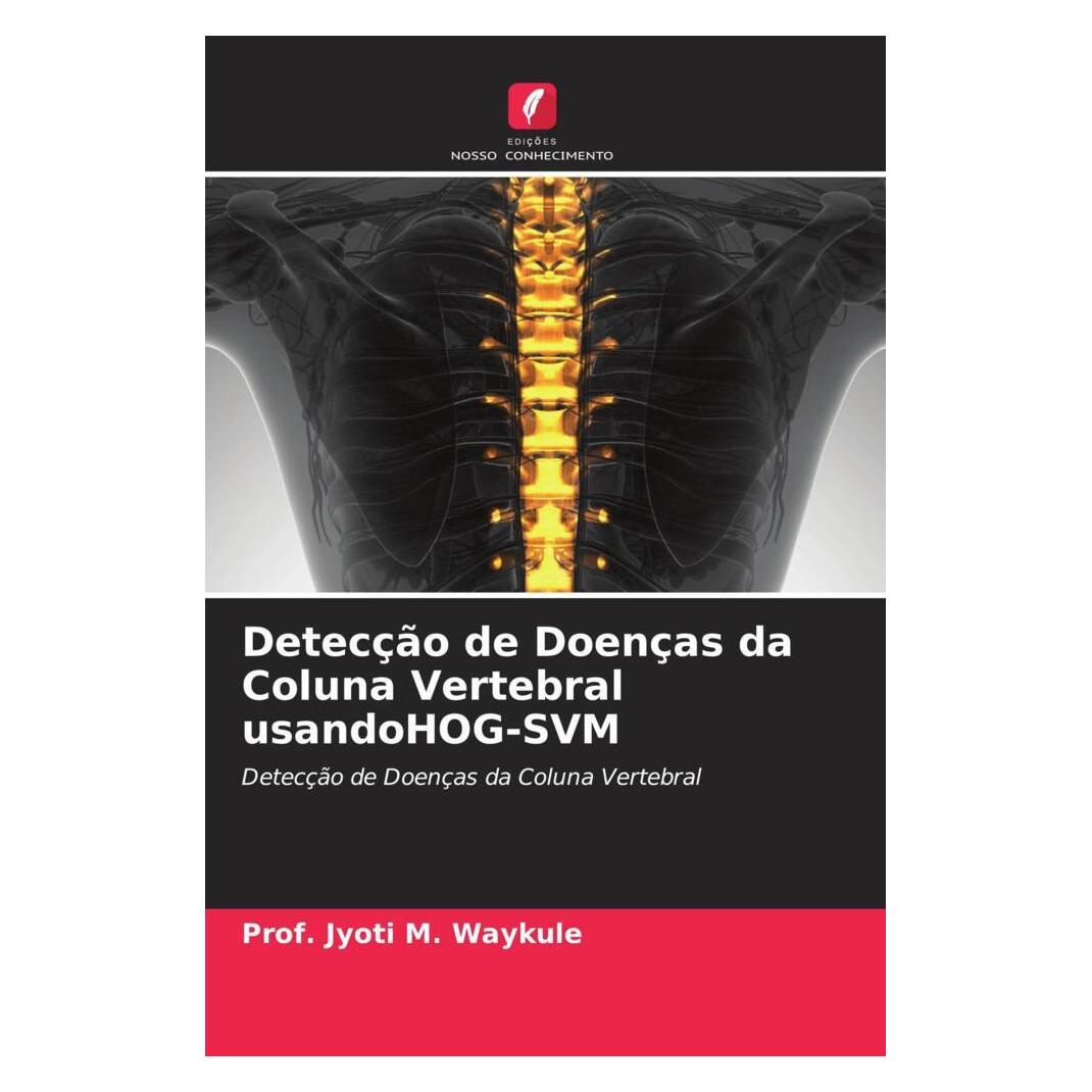 Edicoes Nosso Conhecimento Detecção de Doenças da Coluna Vertebral usandoHOG-SVM (Portugiesisch, Softcover, Prof. Jyoti M. Waykule) (56234009)