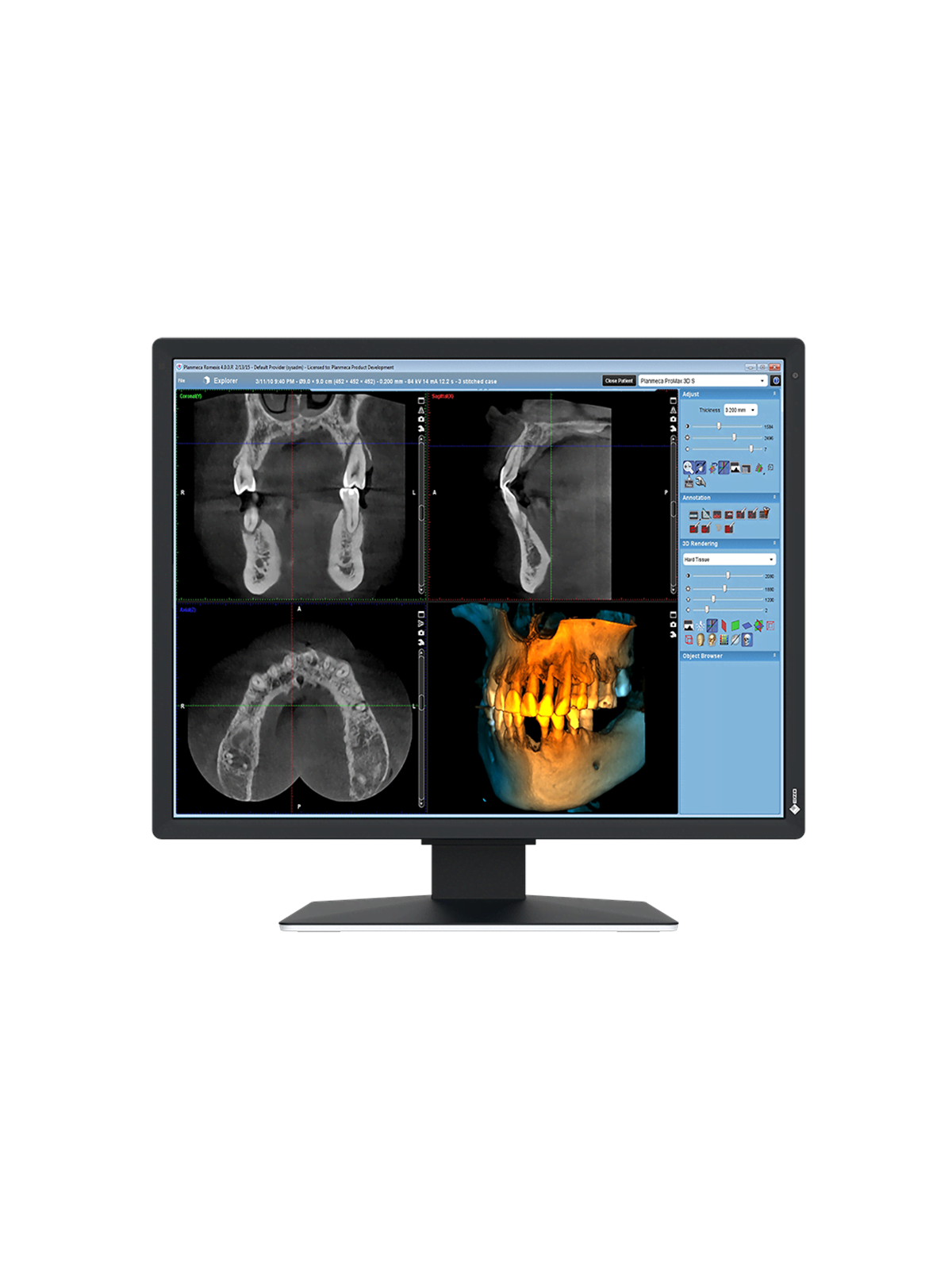 21" EIZO RadiForce MX217-SB - 1200x1600 - IPS