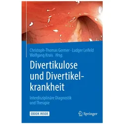 Divertikulose und Divertikelkrankheit, Fachbücher von Christoph-Thomas Germer, Wolfgang Kruis, Ludger Leifeld