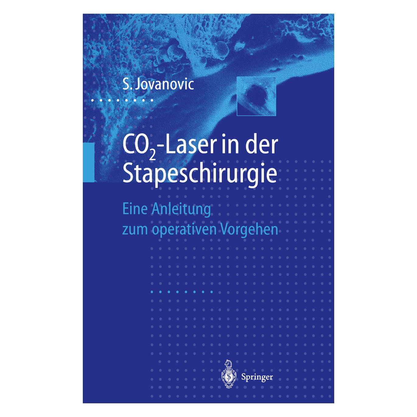 Springer CO2-Laser in der Stapeschirurgie (Deutsch, Softcover, Sergije Jovanovic) (55560819)