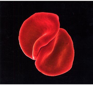 Peter Gabriel - Scratch My Back (Special Edition) - Preis vom 09.10.2026 07:28:09 h