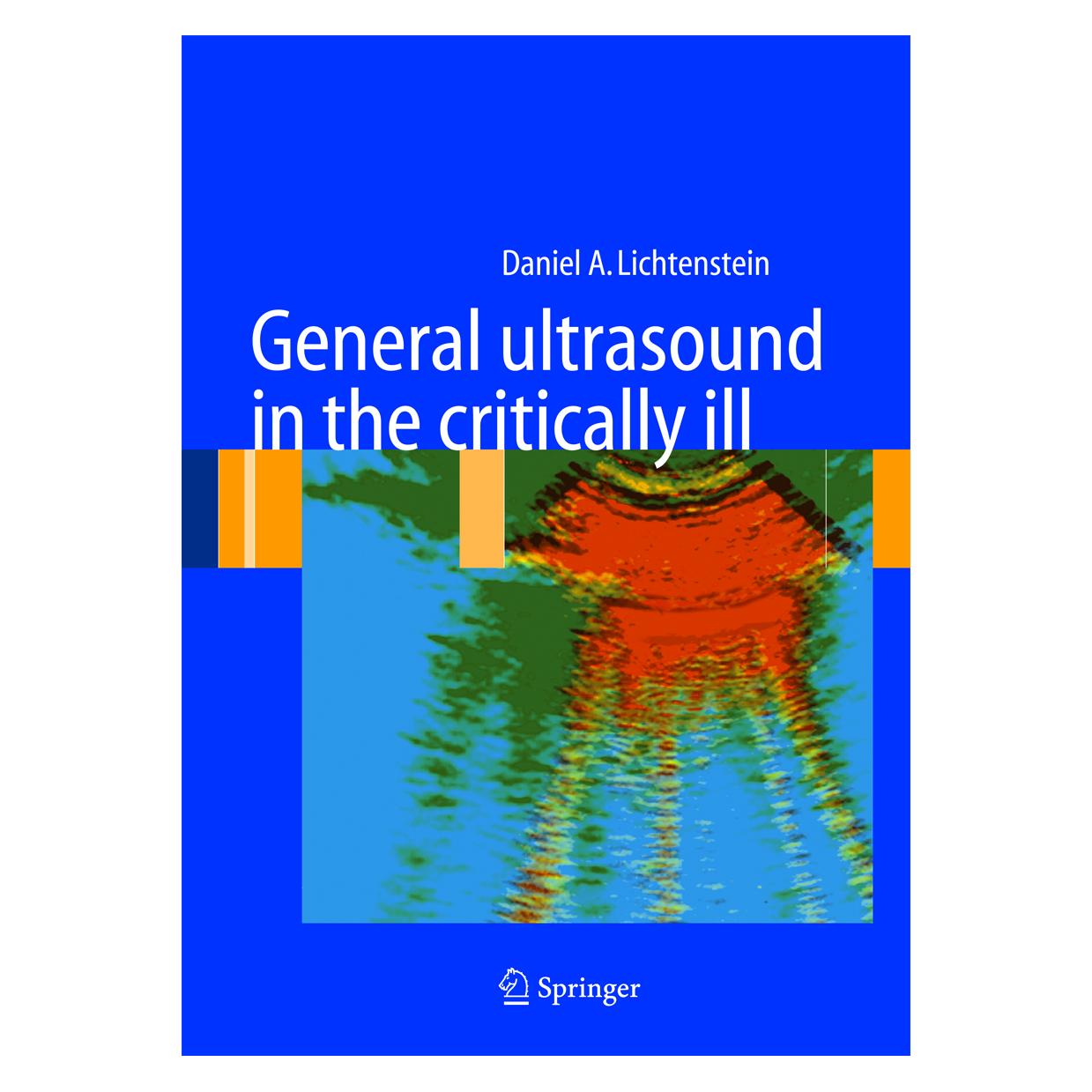 Springer Lichtenstein:General ultrasound in the (Englisch, Hardcover, Daniel A Lichtenstein, Daniel A. Lichtenstein) (63535941)