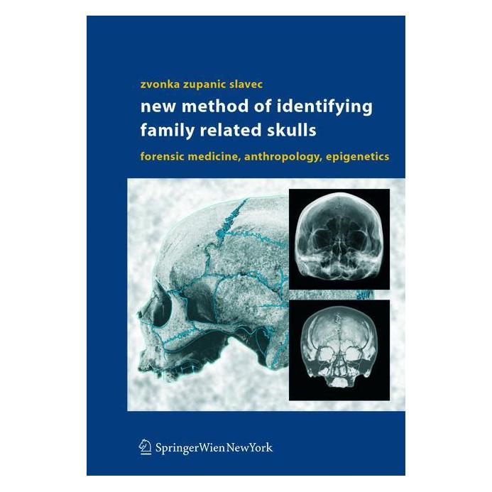 Springer New Method of Identifying Family Related Skulls (Englisch, Softcover, Zvonka Zupanic Slavec) (25369200)