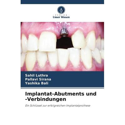 Implantat-Abutments und -Verbindungen, Taschenbuch von Sahil Luthra,Pallavi Sirana,Yashika Bali, Verlag Unser Wissen, 978-620-4-62916-2