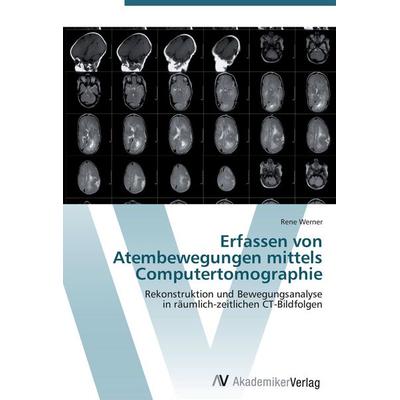 Erfassen von Atembewegungen mittels Computertomographie, Taschenbuch von Rene Werner, AV Akademikerverlag, 978-3-639-40675-7