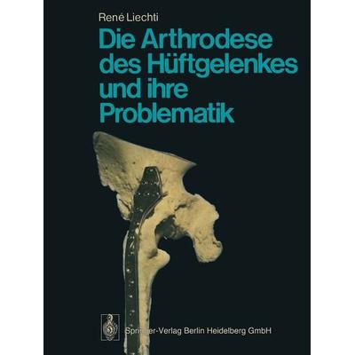 Die Arthrodese des Hüftgelenkes und ihre Problematik, Taschenbuch von R. Liechti, Springer Berlin, 978-3-662-06626-3