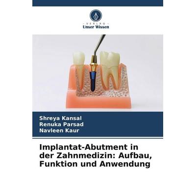 Implantat-Abutment in der Zahnmedizin: Aufbau, Funktion und Anwendung, Taschenbuch von Shreya Kansal,Renuka Parsad,Navleen Kaur, Verlag Unser Wissen
