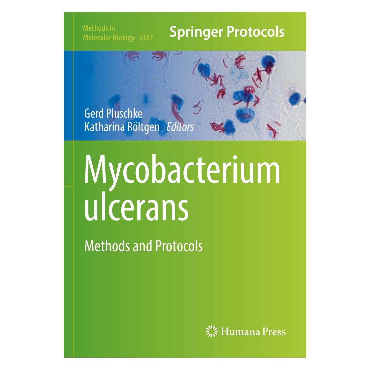 Springer Mycobacterium ulcerans (Englisch, Softcover, Gerd Pluschke, Katharina Röltgen) (56895846)