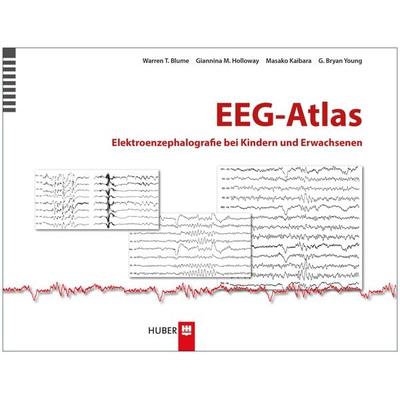 EEG-Atlas, Gebundene Ausgabe von Warren Thomas Blume,Giannina M. Holloway,Masako Kaibara,G. Bryan Young, Hogrefe AG, 978-3-456-85264-5