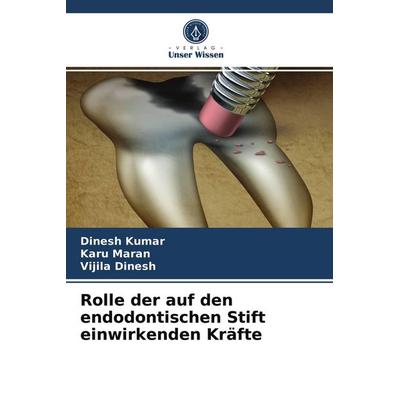 Rolle der auf den endodontischen Stift einwirkenden Kräfte, Taschenbuch von Dinesh Kumar,Karu Maran,Vijila Dinesh, Verlag Unser Wissen,