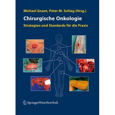 Chirurgische Onkologie, Gebundene Ausgabe von Michael Gnant,Peter M. Schlag, Springer Wien