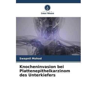 Knocheninvasion bei Plattenepithelkarzinom des Unterkiefers, Taschenbuch von Swapnil Mohod, Verlag Unser Wissen, 978-620-5-28682-1