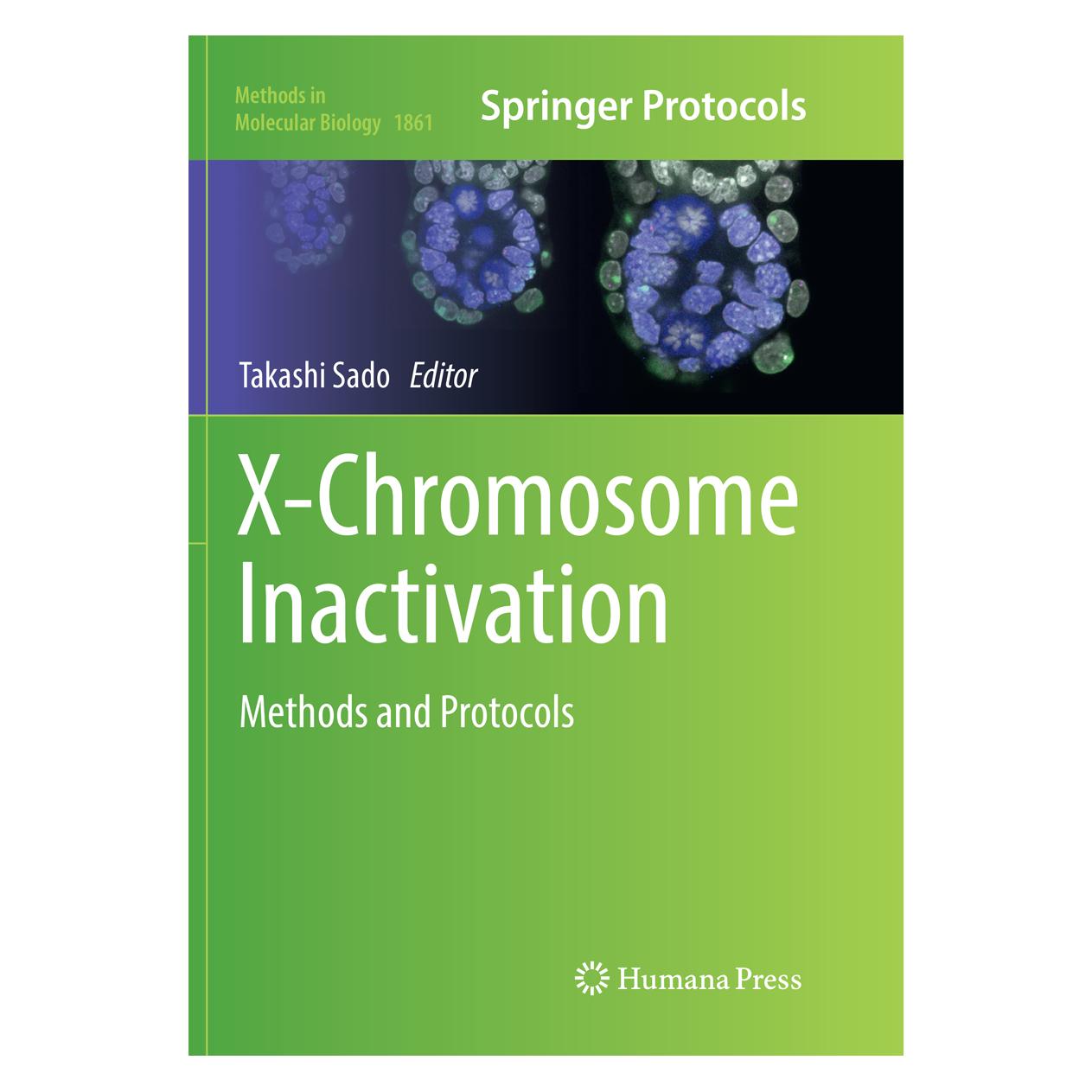 Springer X-Chromosome Inactivation (Englisch, Softcover, Takashi Sado) (56097302)