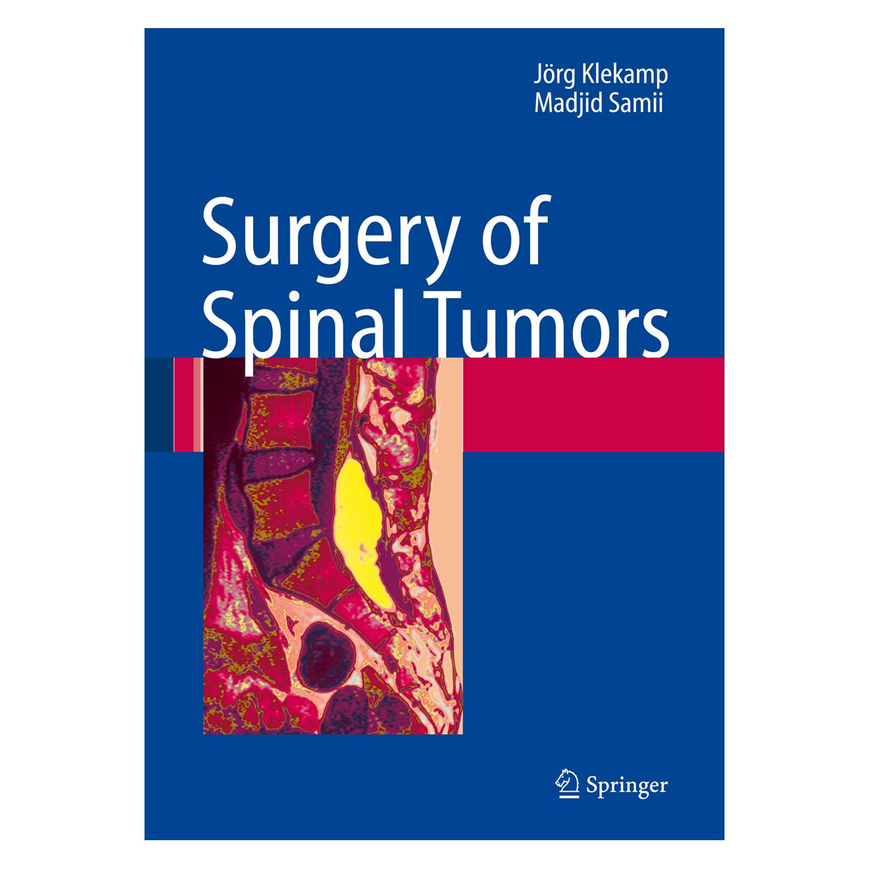 Springer Surgery of Spinal Tumors (Englisch, Hardcover, Jörg Klekamp, Madjid Samii) (9783540447146)