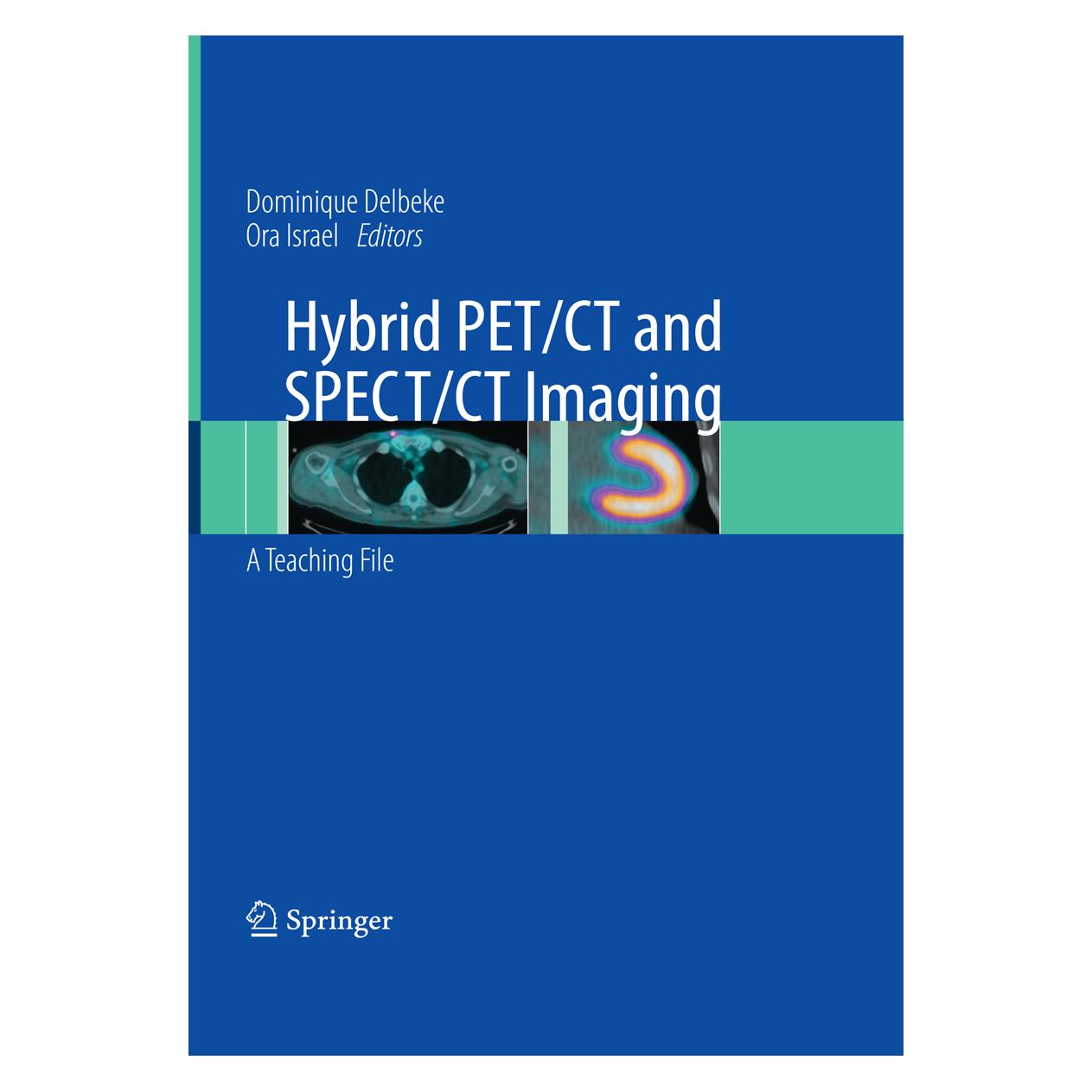 Springer Hybrid PET/CT and SPECT/CT Imaging (Englisch, Softcover, Dominique Delbeke, Ora Israel) (55891552)