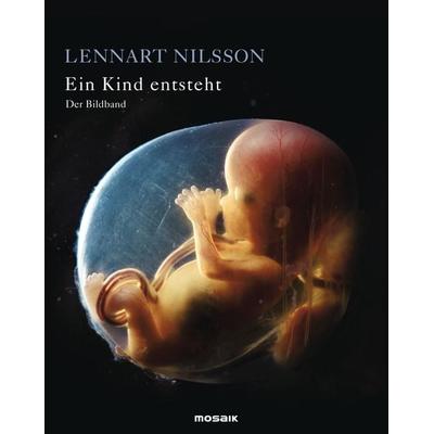 Ein Kind entsteht - Der Bildband, Gebundene Ausgabe von Lennart Nilsson,Lars Hamberger, Mosaik