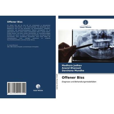 Offener Biss, Taschenbuch von Madhura Jadhav,Anand Bhansali,Darshana Mundhe, Verlag Unser Wissen, 978-620-4-02031-0