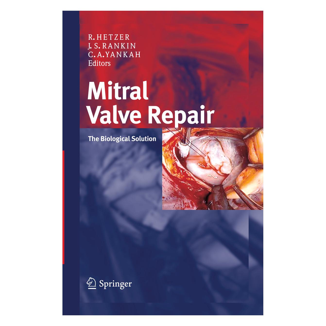 Dr. Dietrich Steinkopff Mitral Valve Repair (Englisch, Softcover, Charles Abraham Yankah, J. Scott Rankin, Roland Hetzer) (55578835)