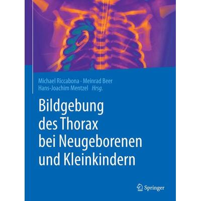 Bildgebung des Thorax bei Neugeborenen und Kleinkindern, Gebundene Ausgabe von , Springer Berlin, 978-3-662-57813-1