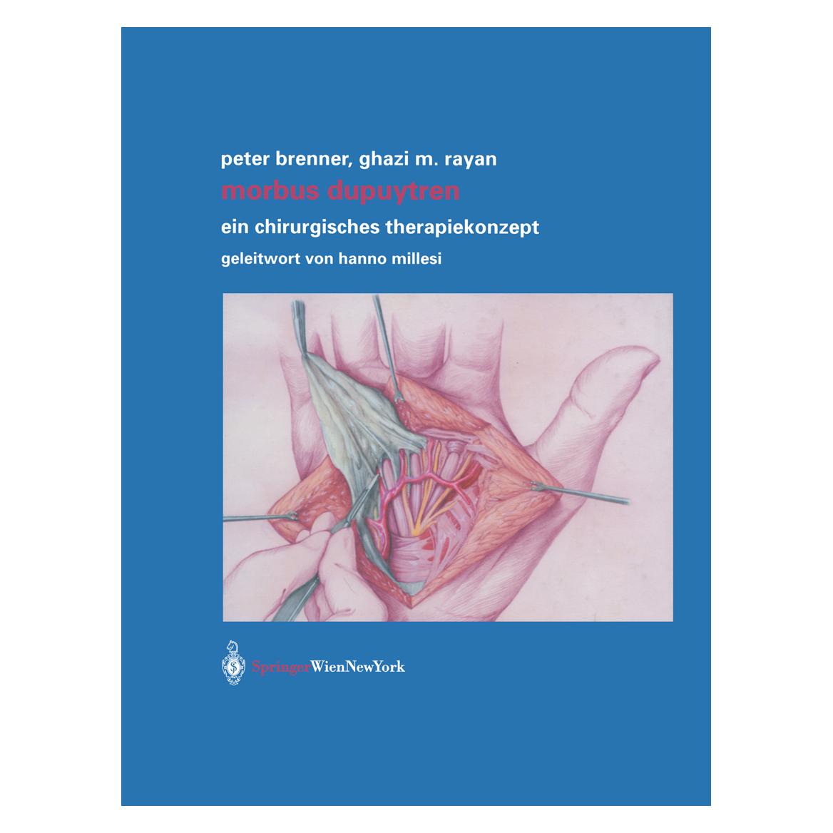 Springer Morbus Dupuytren (Deutsch, Softcover, Ghazi M. Rayan, Peter Brenner) (7838326)
