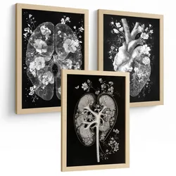 POSTER Set aus 3 Anatomie Drucke und mit Inneren Organen Gehirn Herz Nieren Minimalistisches Schwarz Weiß Design Größe Leichter Holzrahmen A4