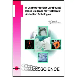 IVUS (IntraVascular UltraSound) Image Guidance for Treatment of Aorto-Iliac Pathologies, Fachbücher von Angel Herrero Flores, Jörg Tessarek