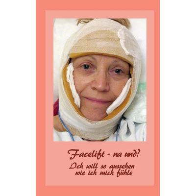 Facelift - na und?, Taschenbuch von Ute Fischer,Bernhard Siegmund, BoD – Books on Demand, 978-3-7322-3815-6
