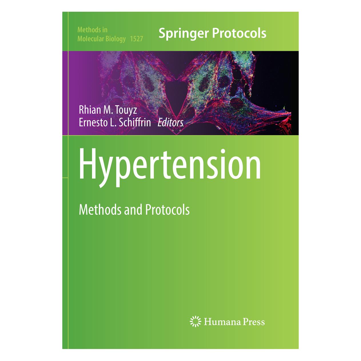 Springer Hypertension (Englisch, Softcover, Ernesto L. Schiffrin, Rhian M. Touyz) (56006231)