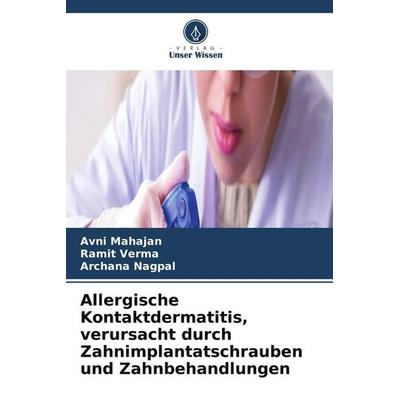Allergische Kontaktdermatitis, verursacht durch Zahnimplantatschrauben und Zahnbehandlungen, Taschenbuch von Avni Mahajan,Ramit verma,Archana Nagpal,
