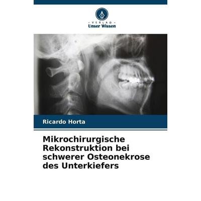 Mikrochirurgische Rekonstruktion bei schwerer Osteonekrose des Unterkiefers, Taschenbuch von Ricardo Horta, Verlag Unser Wissen