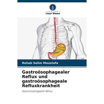 Gastroösophagealer Reflux und gastroösophageale Refluxkrankheit, Taschenbuch von Rehab Selim Moustafa, Verlag Unser Wissen, 978-620-9-30640-2