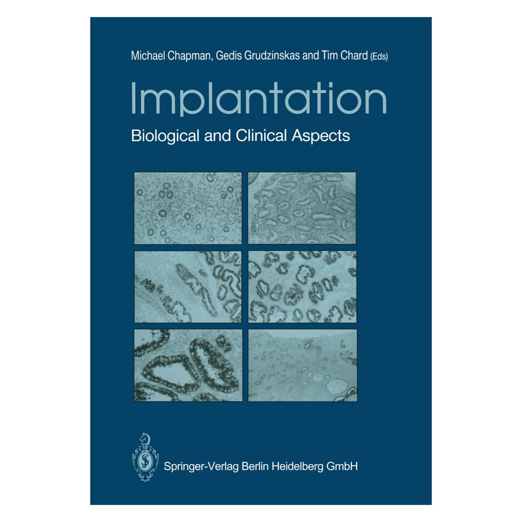 Springer Implantation (Englisch, Softcover, Gedis Grudzinskas, Michael G. Chapman, Tim Chard) (55528571)