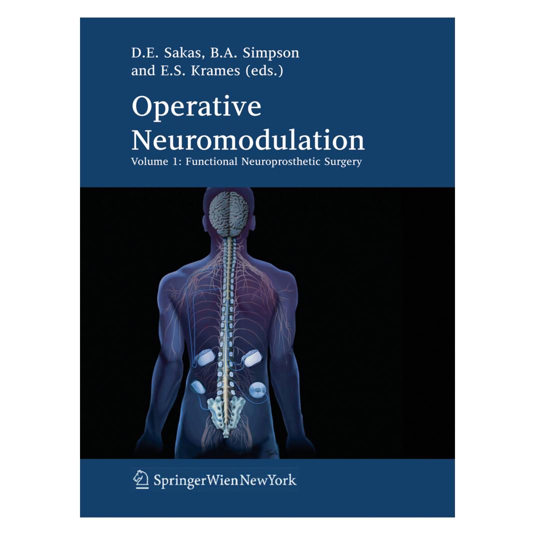 Springer Operative Neuromodulation (Englisch, Softcover, Brian Simpson, Damianos E. Sakas, Elliot S. Krames) (55376988)