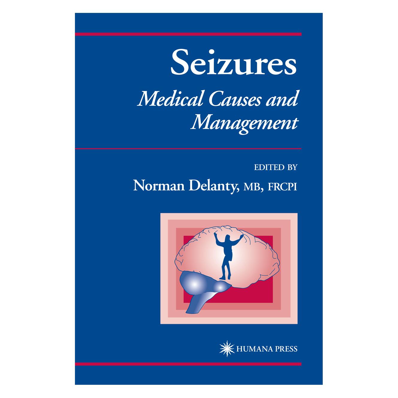 Springer Seizures (Englisch, Softcover, Norman Delanty) (55382521)
