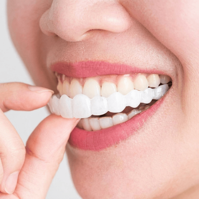 Multisell Products Hub Snap On Teeth Veneers, Temporary Dentures For Men And Women, Instant Confident Smile Cover, Oral Hygiene Tool Snap On Teeth Veneers, Temporary Dentures For Men And Women, Instant Confident Smile Cover, Oral Hygiene Tool