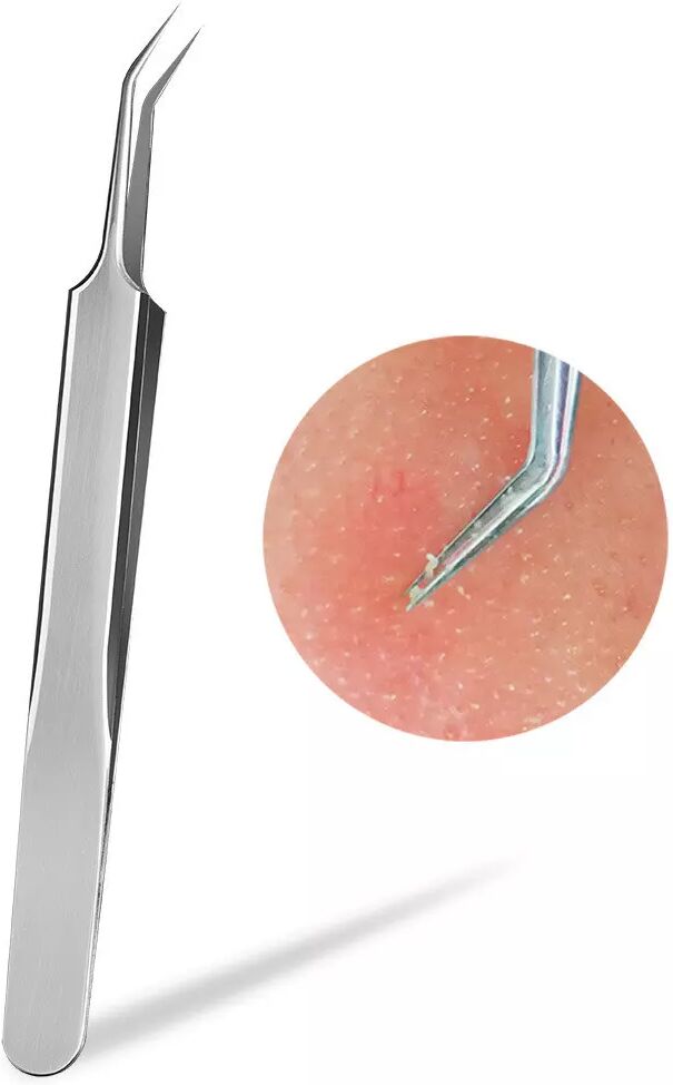 INF Extracteur de pores en acier inoxydable, pack de 3
