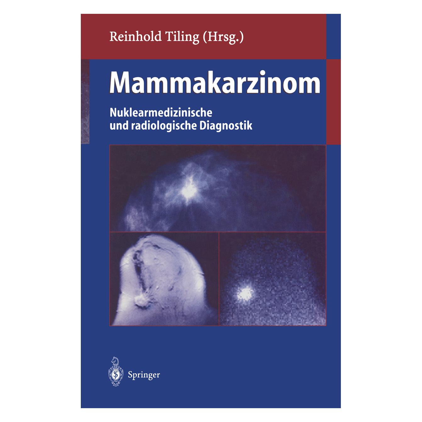 Springer Mammakarzinom (Deutsch, Softcover, Reinhold Tiling) (55560820)