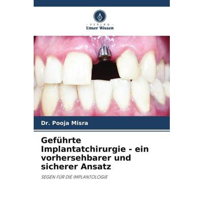 Geführte Implantatchirurgie - ein vorhersehbarer und sicherer Ansatz, Taschenbuch von Pooja Misra, Verlag Unser Wissen, 978-620-5-16475-4