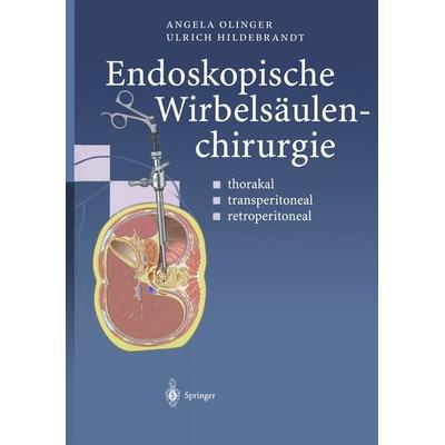 Endoskopische Wirbelsäulenchirurgie, Taschenbuch von Angela Olinger,Ulrich Hildebrandt, Springer Berlin, 978-3-642-63058-3